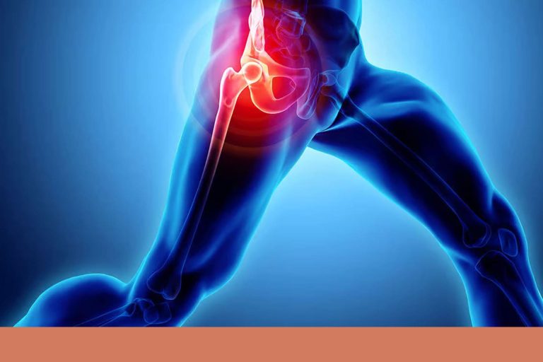 Упражнения от боли - Боль в бедре