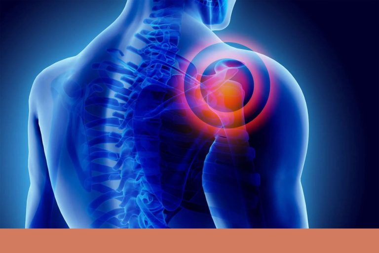 Упражнения от боли - Боль в плече