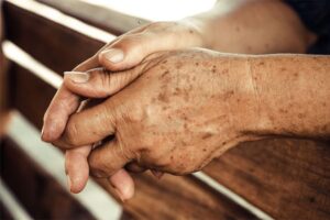 Age spots on the skin