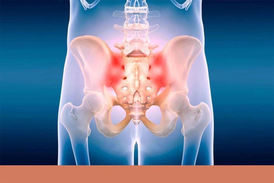 Exercises for pain - Sacroiliac joint pain and sciatica